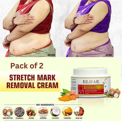 Stretch Mark Removal Cream (Pack of 2) 0c2542-3a