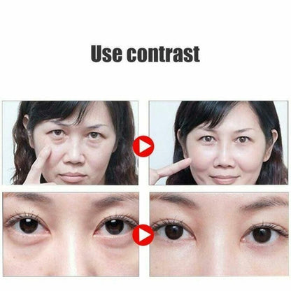 Remove Dark Circles Wrinkles Eye Bags Fat Granules Serum Oil 0c2542-3a