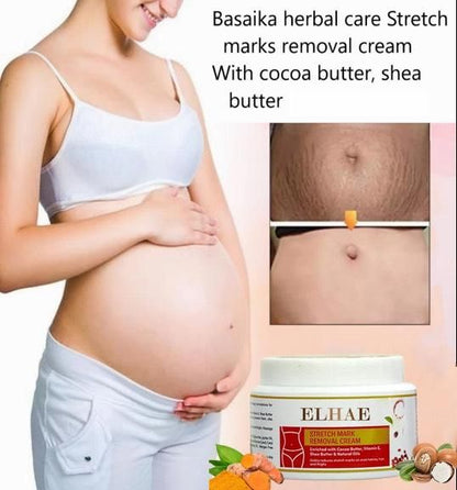 Stretch Mark Removal Cream (Pack of 2) 0c2542-3a