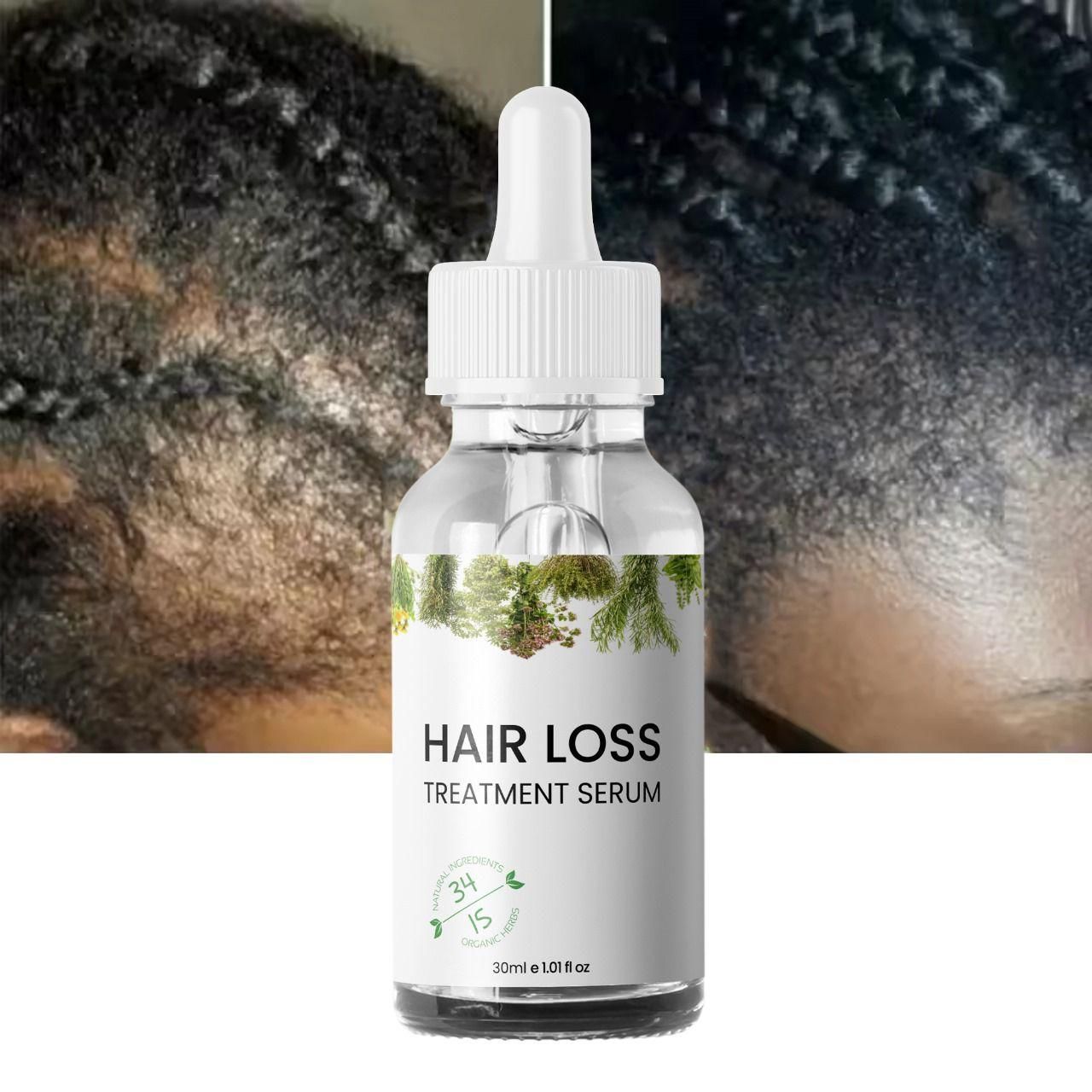 Hair Loss Treatment Serum 30Ml (Pack Of 2) 0c2542-3a