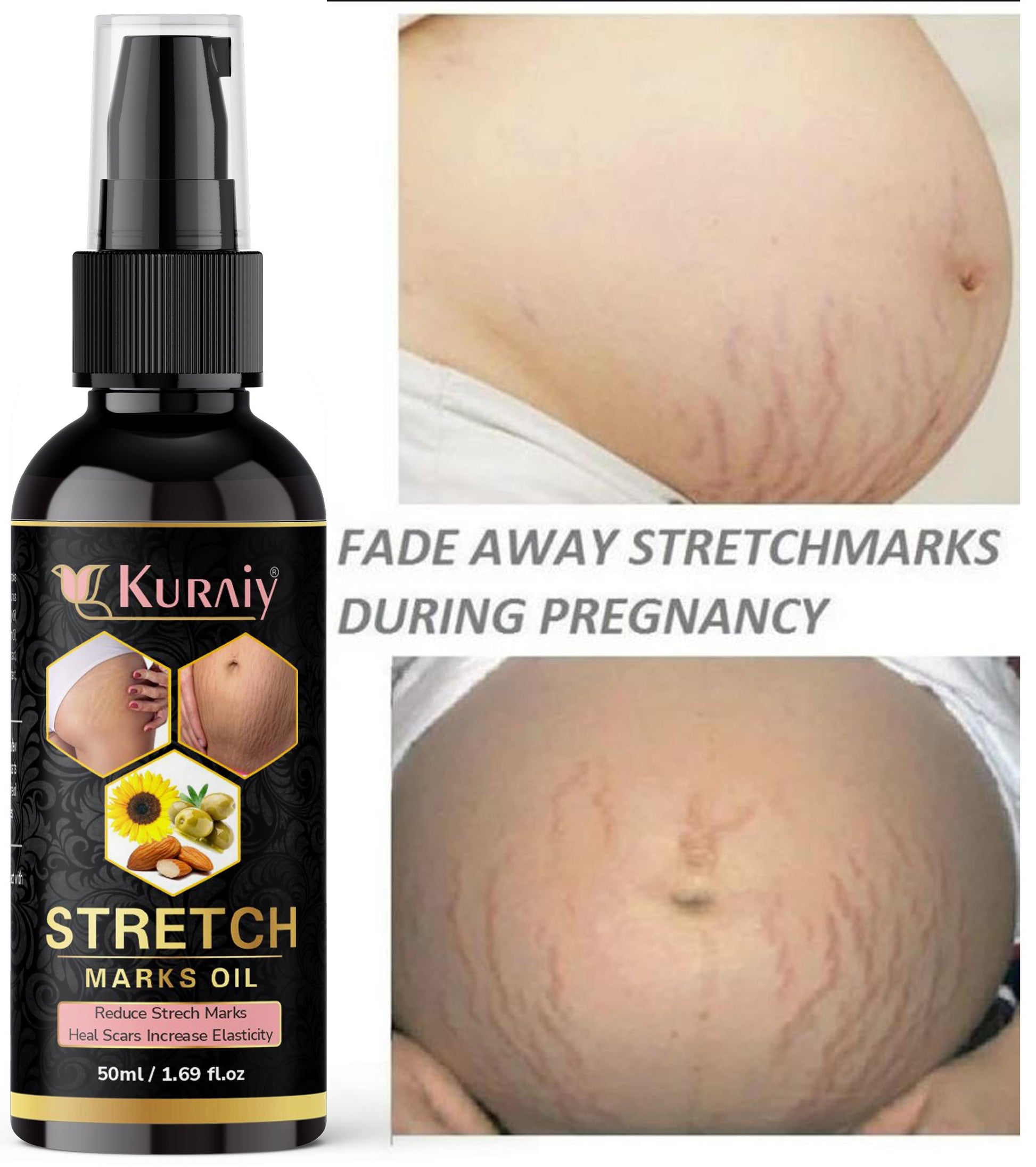 Kuraiy present Repair Stretch Marks Removal - Natural Heal Pregnancy Breast, Hip, Legs, Mark oil 500 ml pack of 1 0c2542-3a