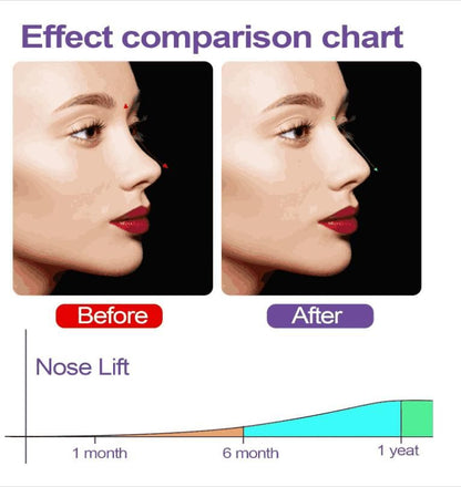 Nose Up Clip High Lifting Clipper Correction For Shaping Nose Tool 0c2542-3a