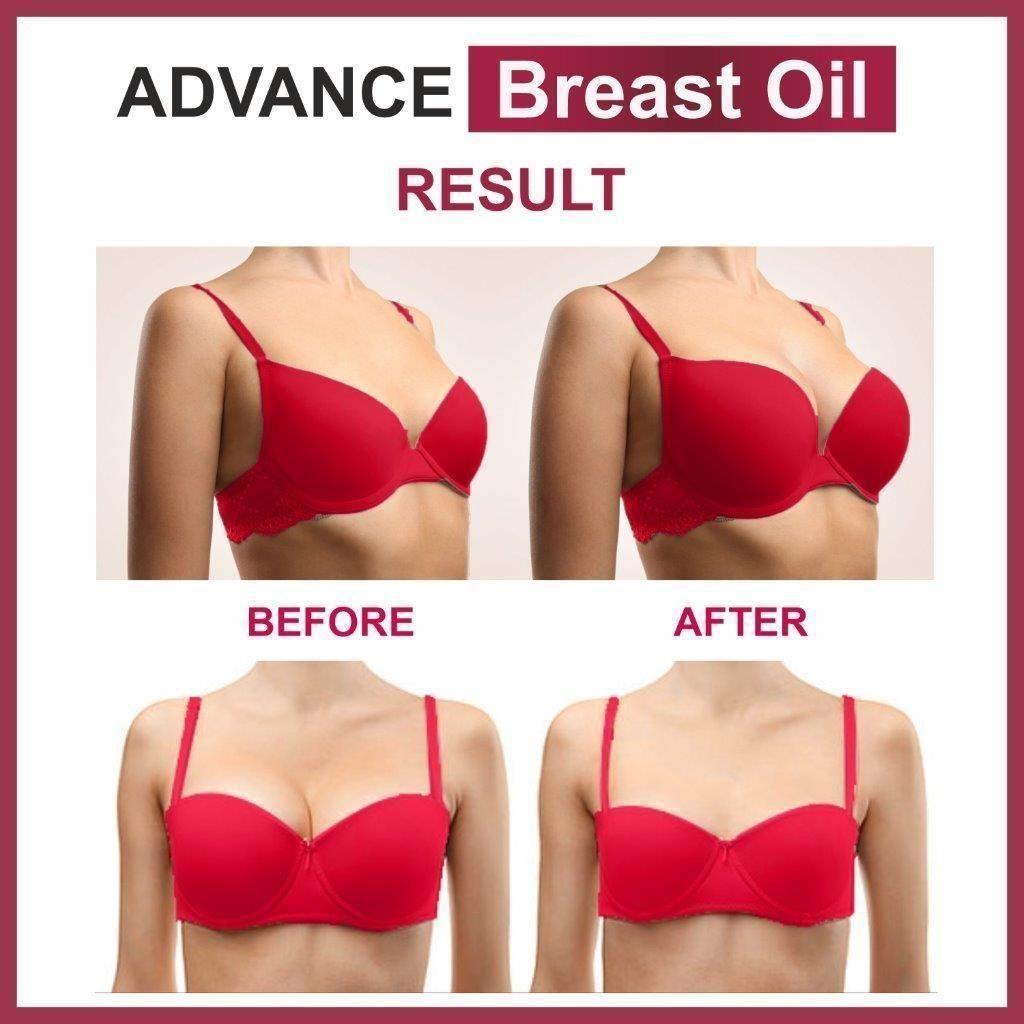 Advance Breast Oil (Pack of 2) 0c2542-3a