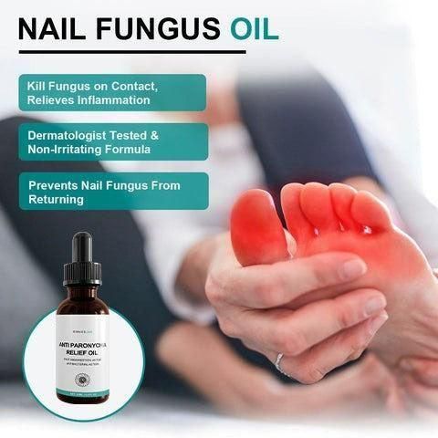 Anti Paronychia Nail Fungus Oil (Pack of 1) 0c2542-3a