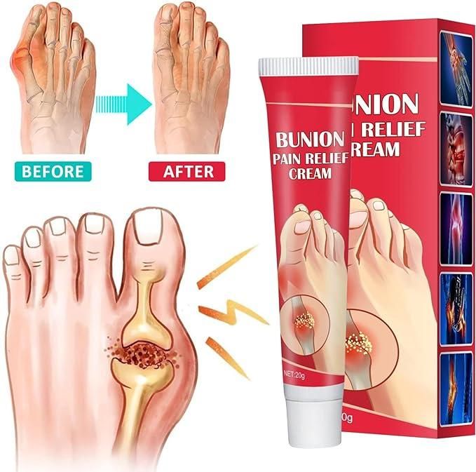 Bunion Pain Relief Cream (Pack Of 2) 0c2542-3a