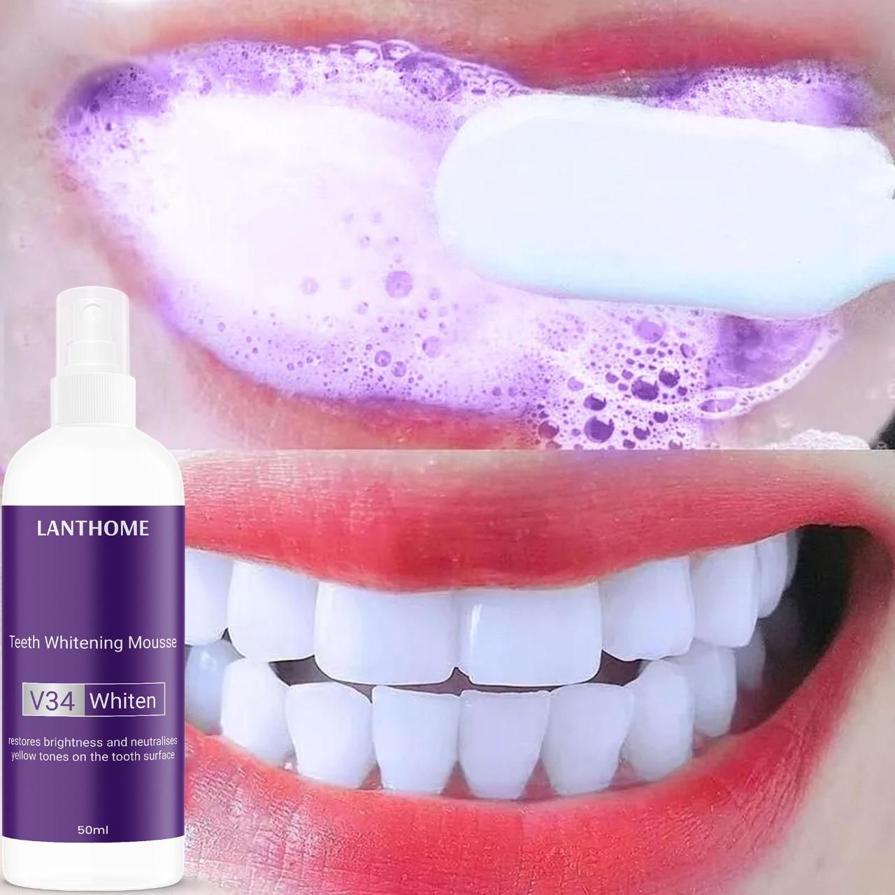 Lanthome Teeth Whitening Spray Mousse V34 Whiten 50ml (Pack Of 2) 0c2542-3a