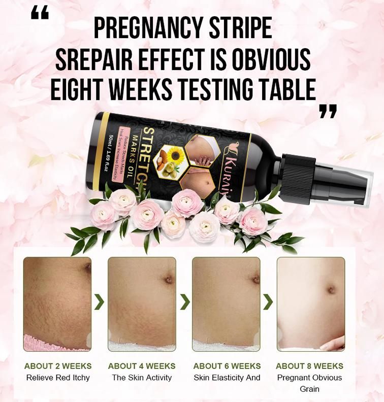 Kuraiy present Repair Stretch Marks Removal - Natural Heal Pregnancy Breast, Hip, Legs, Mark oil 500 ml pack of 1 0c2542-3a