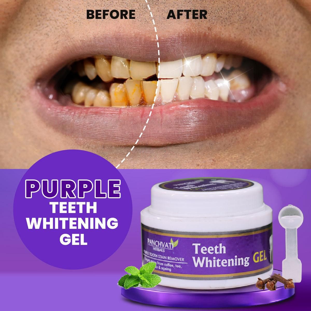 Purple Teeth Whitening Gel 0c2542-3a