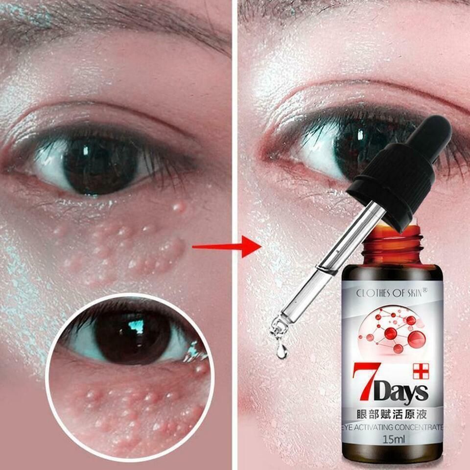 Remove Dark Circles Wrinkles Eye Bags Fat Granules Serum Oil 0c2542-3a