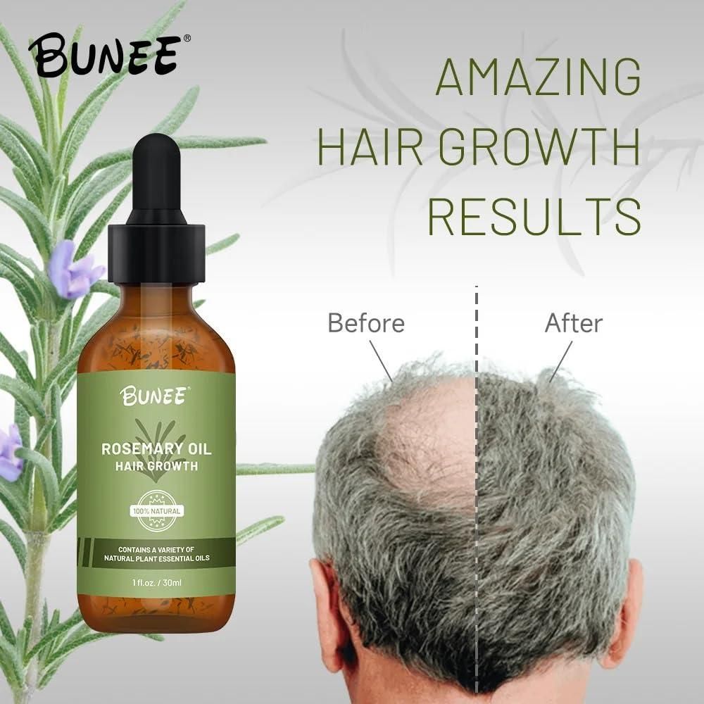 BUNEE Rosemary Hair Growth Serum Oil 30 ML(Pack of 2/3) 0c2542-3a