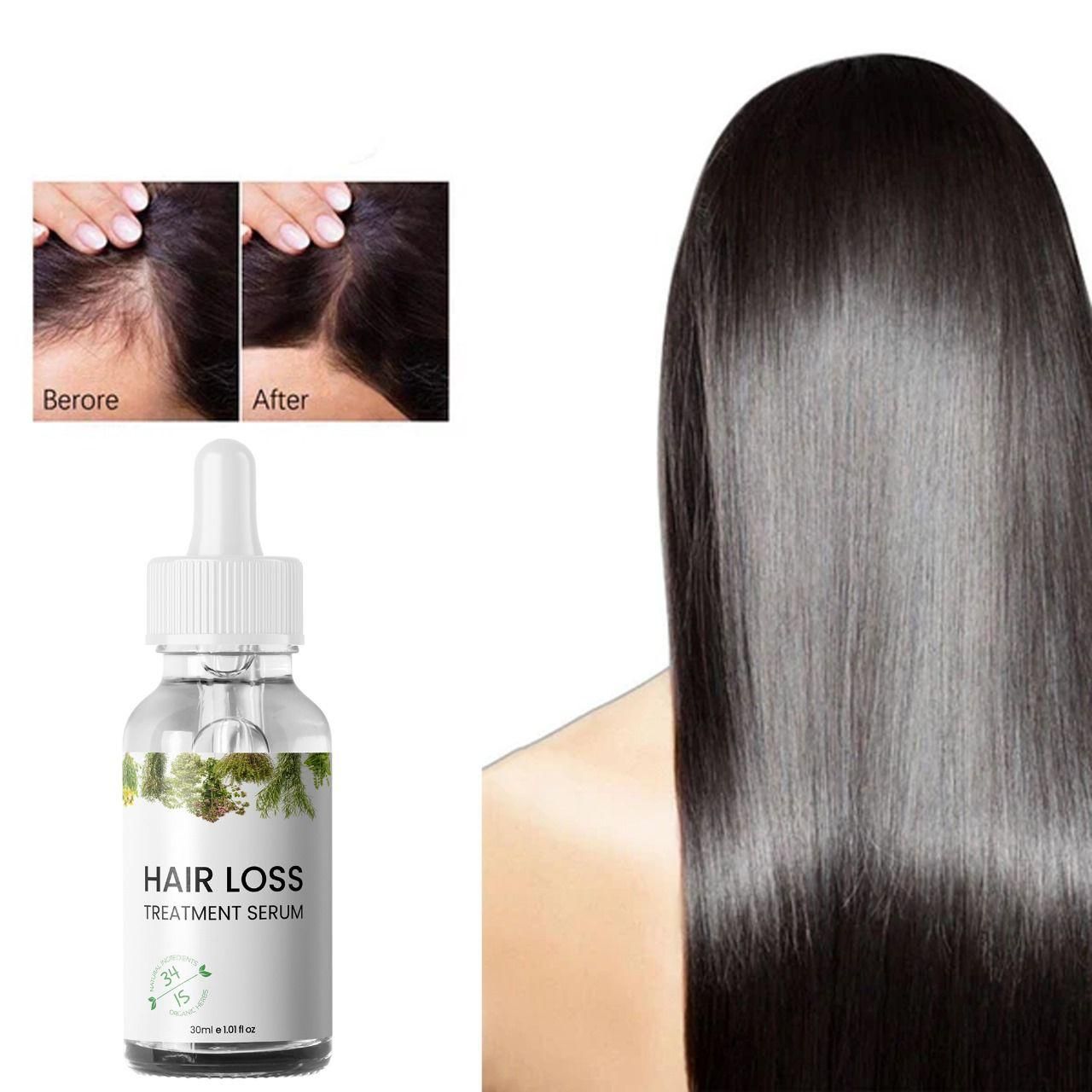 Hair Loss Treatment Serum 30Ml (Pack Of 2) 0c2542-3a